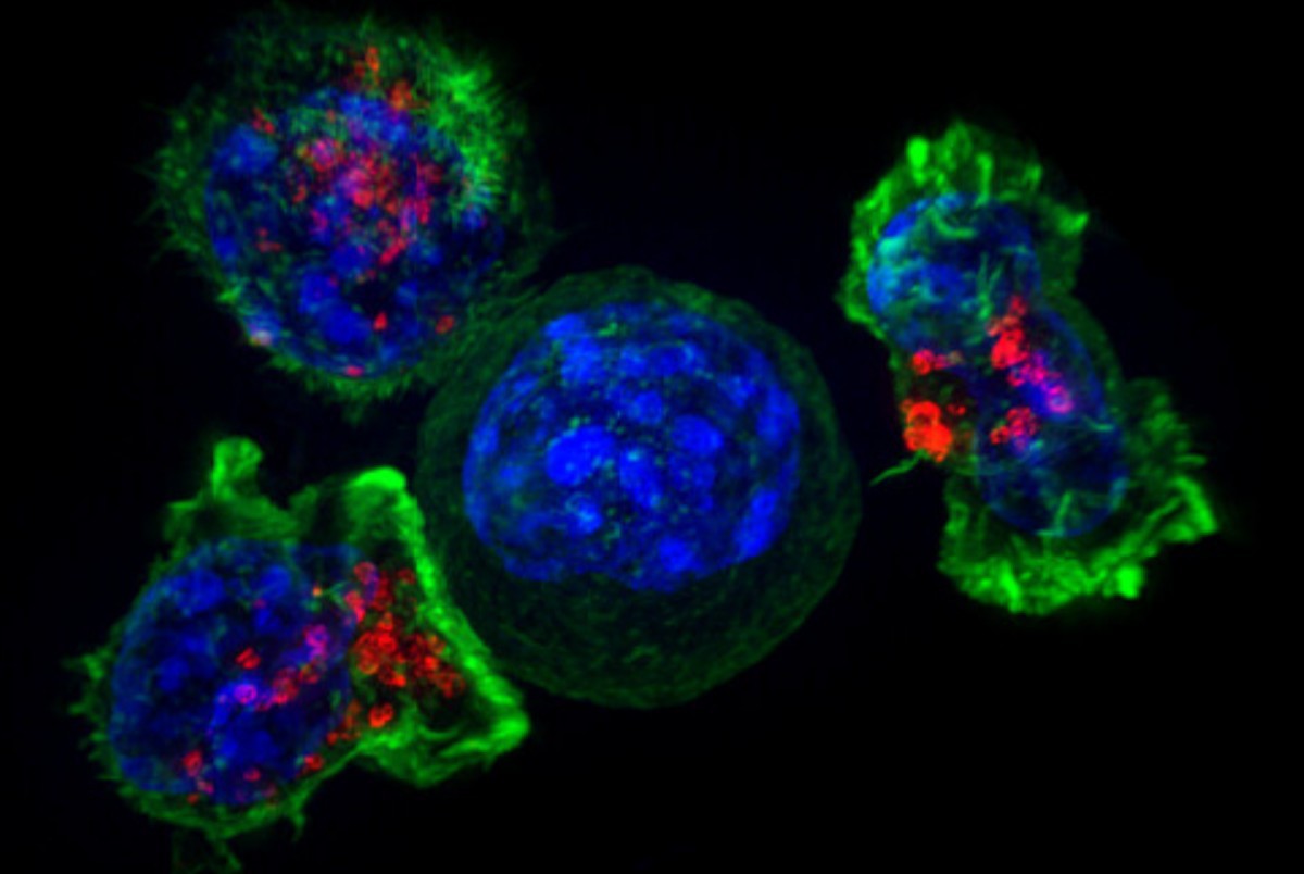 Исследователи обнаружили выход при устойчивости к иммунотерапии рака молочной железы