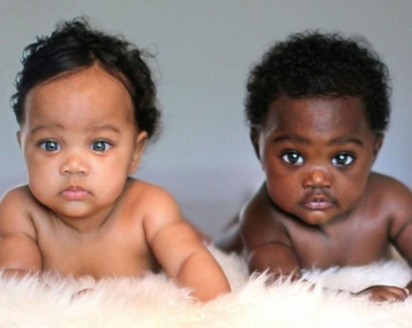 Жительница Канады родила близнецов с разным цветом кожи. медицина, здоровье, врач, семейная пара, ЭКО, близнецы, цвет кожи, Африка, Канада