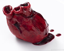 «Останавливать»  ли сердце при кардиохирургических операциях?. 10096.jpeg