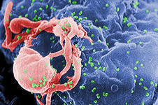 ВИЧ и СПИД: в чем большая разница?. 9250.jpeg