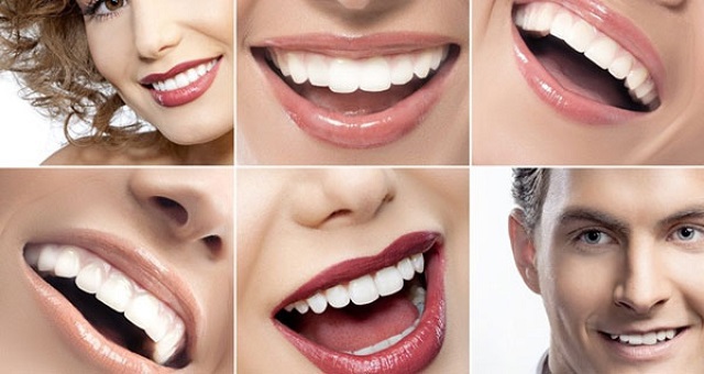 Красивые зубы – красивая улыбка. 15400.jpeg
