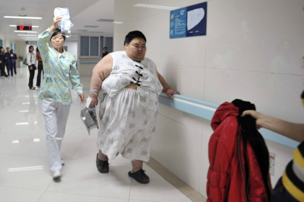 Самый тяжелый человек Китая сбросил 142 килограмма за полгода. 17469.jpeg