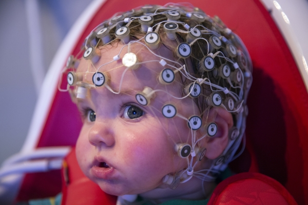 Способы выявления болезней мозга у детей. 16509.jpeg