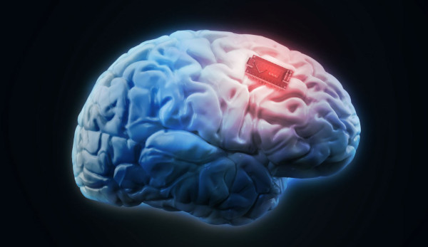 Необычный имплантат восстанавливает связи в головном мозге. 17526.jpeg