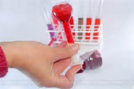 Как правильно подготовиться к анализу крови. анализ крови