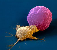 4 февраля — Всемирный день борьбы с раком. онкология