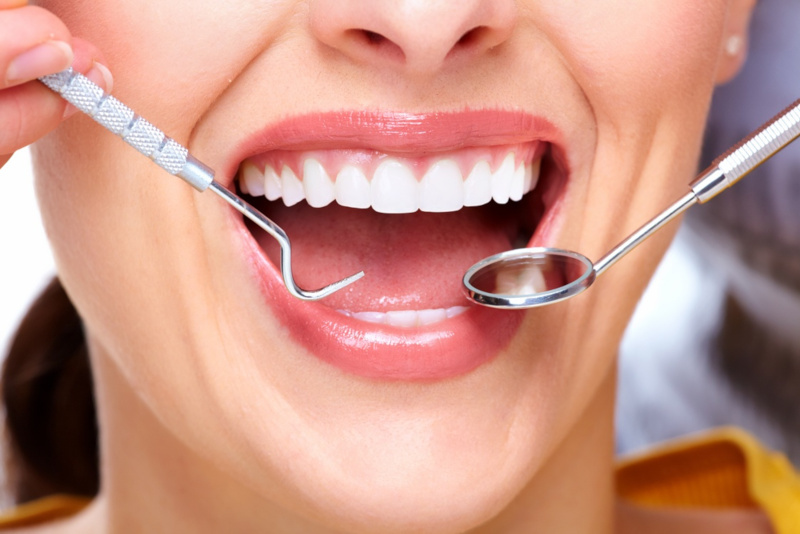 Зубы мудрости: удалять или лечить?. медицина, здоровье, стоматология, зубы