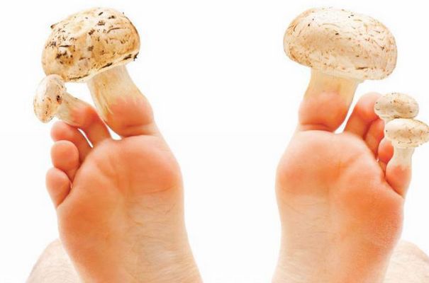 Дерматологи: почему-то на грибок ногтей никто не обращает внимания. грибок ногтей