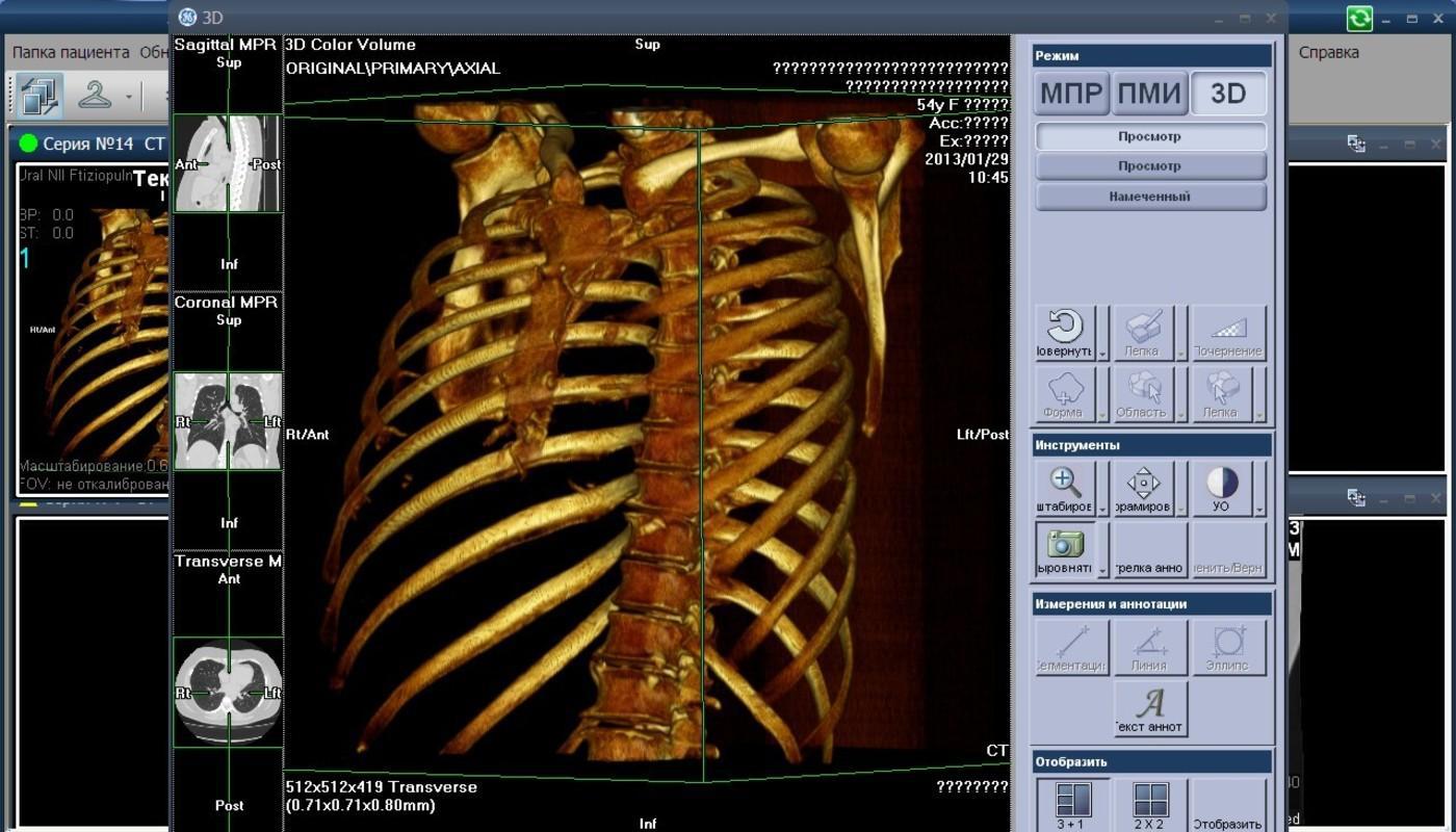 Цветной 3D-рентген позволит обнаруживать смертельные заболевания. 15876.jpeg