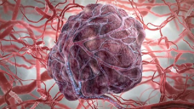 Раковые клетки слабеют в кислой среде. 15881.jpeg