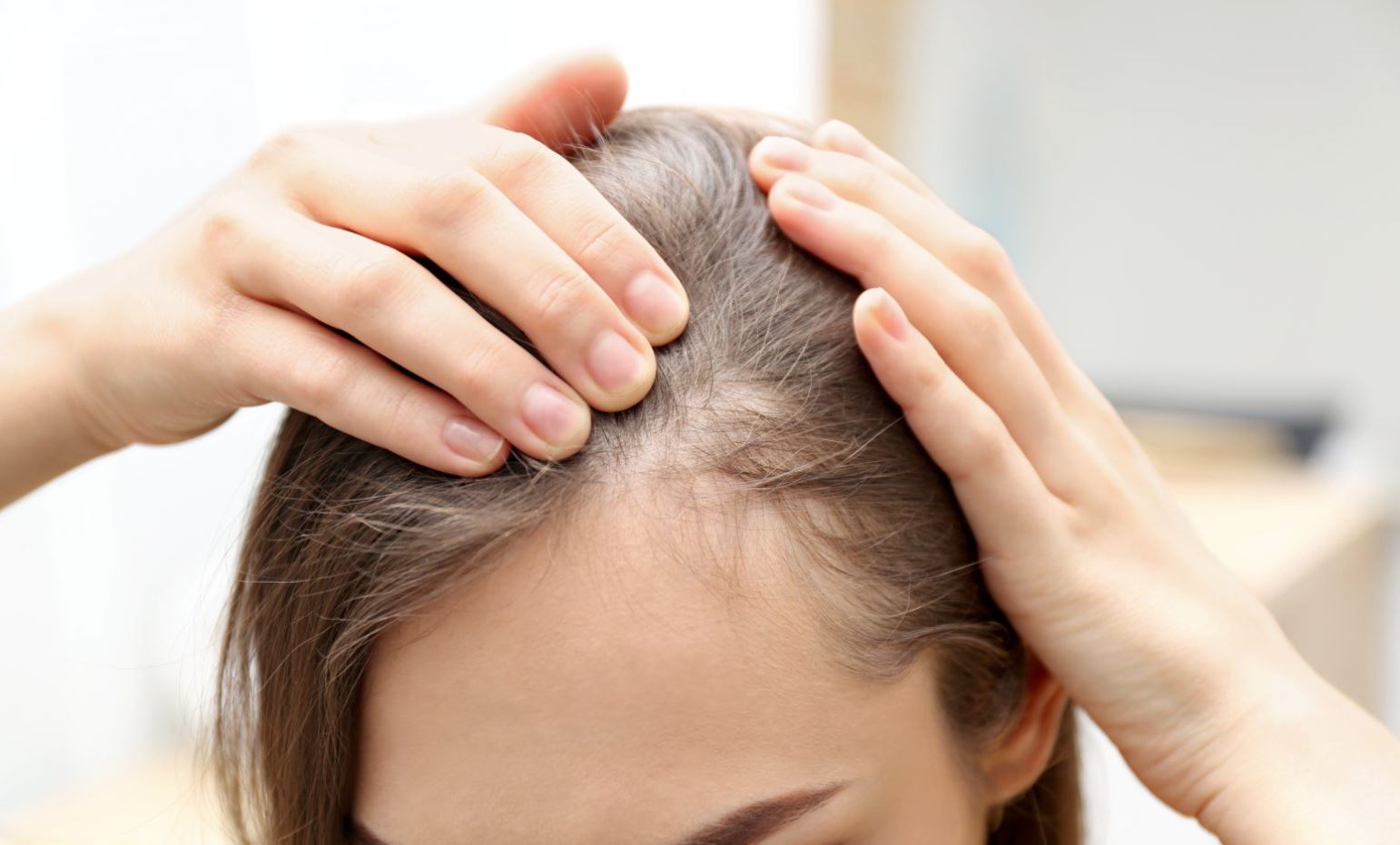 Выпадение волос: причины и методы борьбы с аполецией