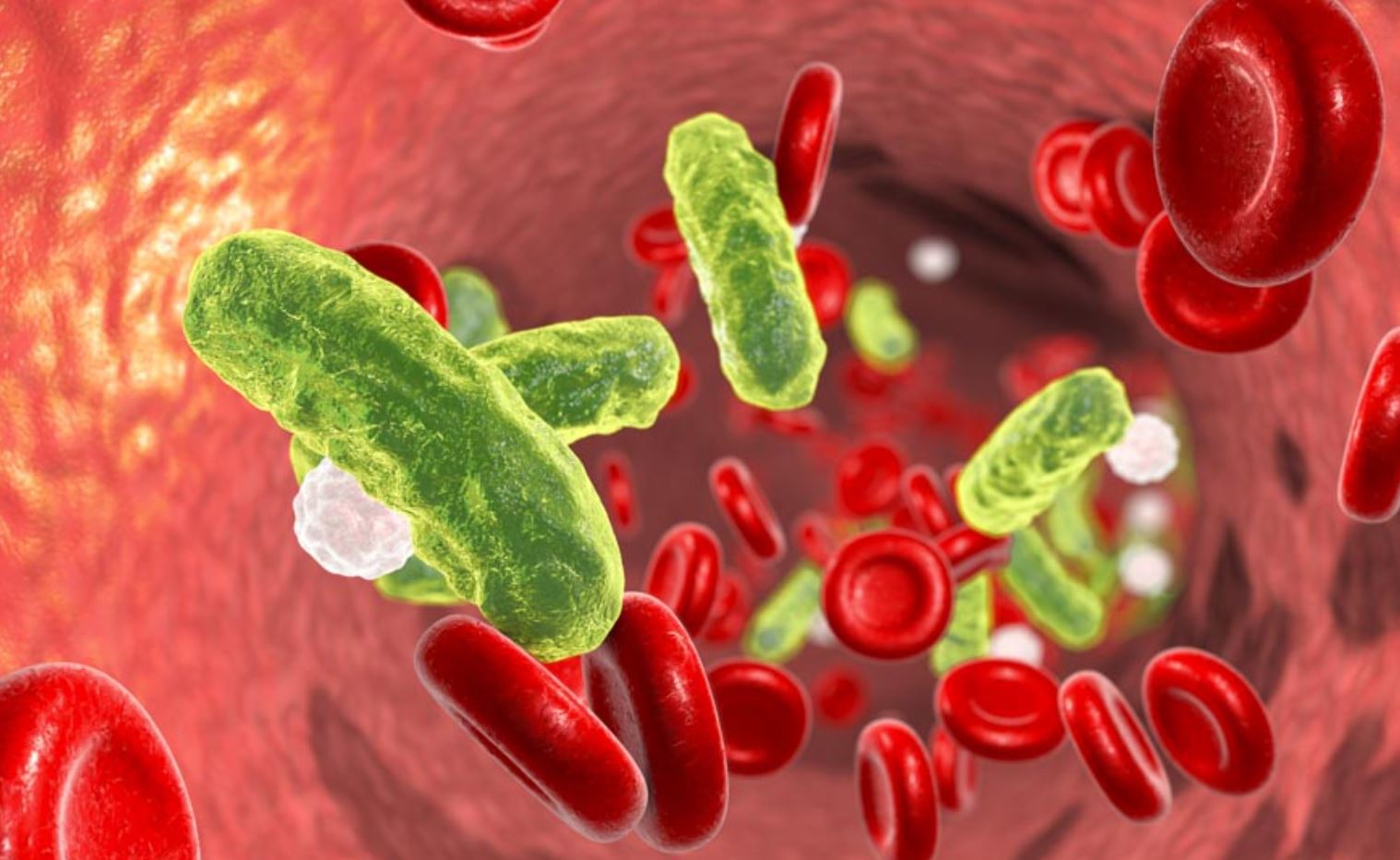 Советы по борьбе с бактериемией или бактериями в крови