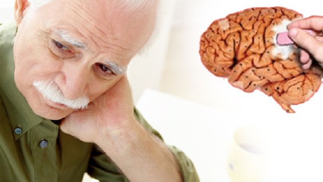 Препарат для печени может лечить болезнь Альцгеймера. 15995.jpeg