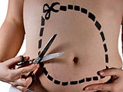 Плоский живот - это радикально!