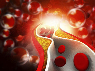 Медики рассказали, чем опасен низкий холестерин