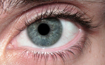 Окулист Миргородская запретила трогать уголки глаз пальцами