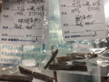 Житель Китая  пять лет страдал мигренью из-за щепок в мозгу