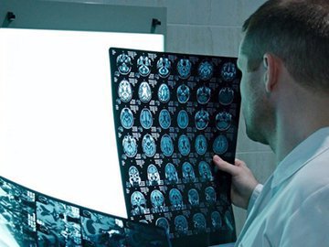 Сканирование мозга предскажет шизофрению