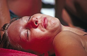 Дерматолог Андрян предупредила об опасности обгорания кожи на солнце