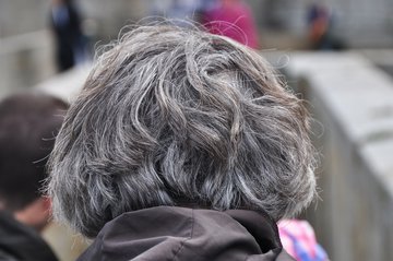 Трихолог Курская: дефицит витамина D не вызывает поседение волос