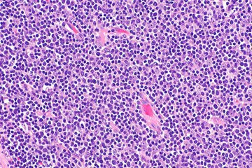 Профессор Финч: препарат GSM-15 606 защищает мозг от загрязненного воздуха