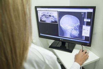 Стоматолог Сумцова: головные боли могут быть следствием заболеваний сустава нижней челюсти