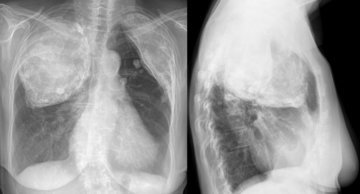 Доктор Джексон: 20 сигарет «отнимают» у человека семь часов жизни