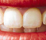 Лучше пара искусственных зубов во рту, чем вставная челюсть в стакане