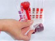Как правильно подготовиться к анализу крови