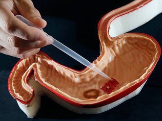 Создана первая в мире "самостоятельная" пипетка