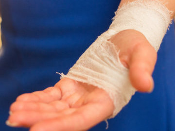 В Северной Осетии уволили врача, который советовал наносить мазь на гипс