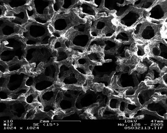 Невролог Балабанова: микроинсульт отличается кратковременной болью в голове