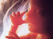 Право на аборт или право на жизнь?