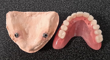 Врач Минко: пародонтоз возникает из-за диабета и атеросклероза