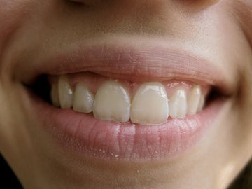 Врач Гусева: пародонтит повышает риск ишемической болезни сердца