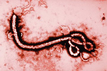 Еще один американец заразился вирусом Эбола