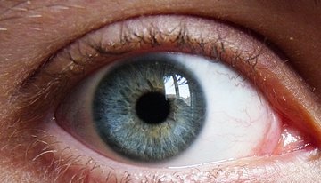 Врач Стоянова: лазерная коррекция зрения проводится от 20 до 25 лет