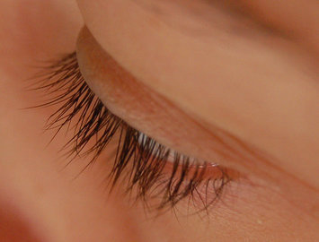 Врач Альфонси: зуд и покалывая могут указывать на рак кожи