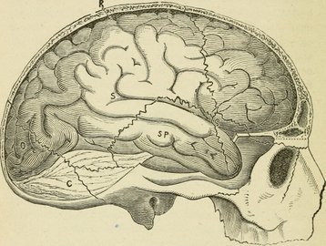 Невролог Махинов: при Альцгеймере больной часто теряет вещи