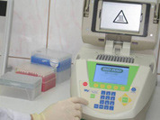 Во Франции разработана экспресс-диагностика гриппа A/H1N1