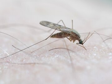 Профессор Шахмарданов: чикунгунья вызывает сыпь на стопах