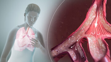 Врач Гадзиян: дефицит витамина В вызывает одышку