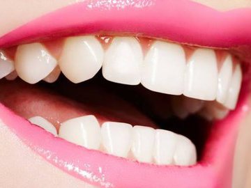 Отбеливание зубов без вреда: простые советы