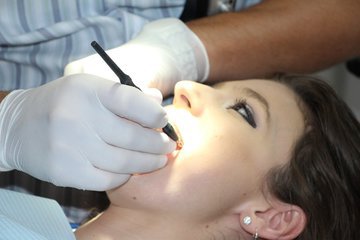 Ученые из США: уход за зубами увеличивает успех лечения рака головы и шеи