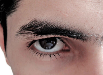 Дерматолог Лебедева: стресс вызывает купероз