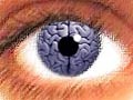 Заболевания мозга можно наблюдать через глаза