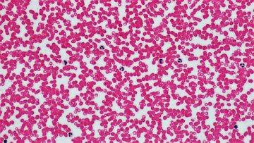 Ученые из Германии создали препарат против образования тромбов