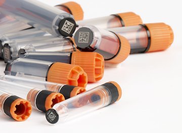 Врач Межер: появление синяков указывает на рак крови