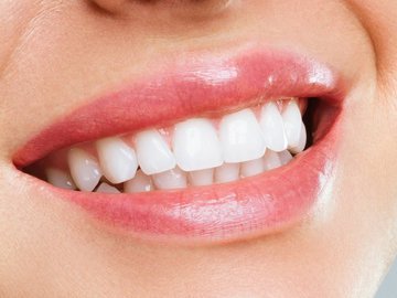 Стоматолог назвал лучшие способы отбеливания зубов