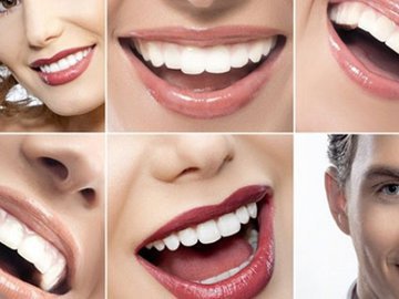 Красивые зубы – красивая улыбка